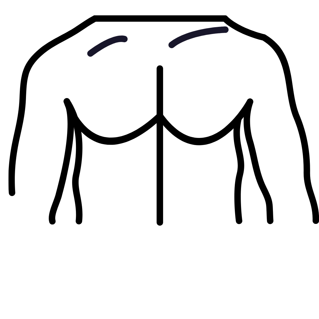 Implantes de Pectoral
