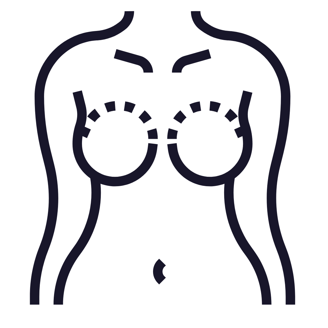 Mamoplastia Aumento de Senos