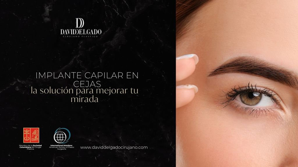 Implante capilar en cejas explicado por el Dr. David Delgado - Clínica Be Dharma hair 2