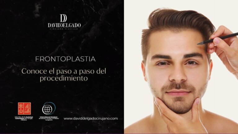 Paso a paso frontoplastia-Dr. David Delgado