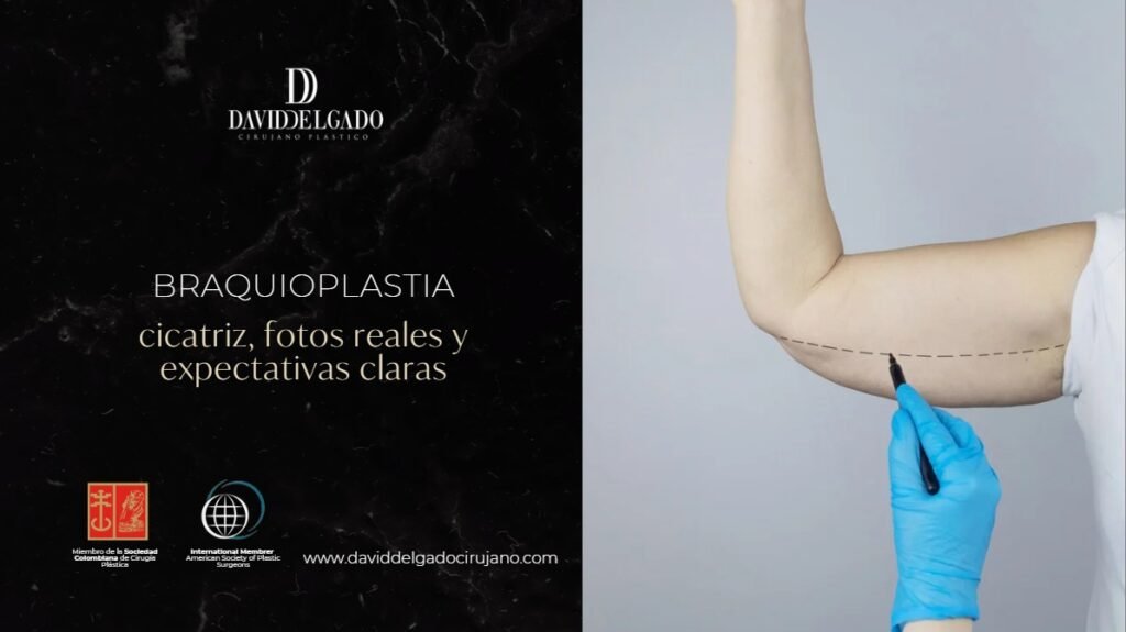 braquioplastia cicatriz fotos-Dr. David Delgado