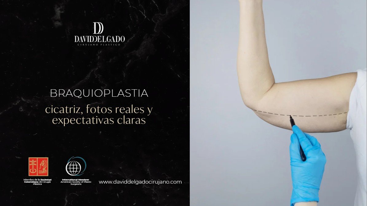 braquioplastia cicatriz fotos-Dr. David Delgado