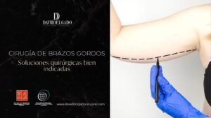cirugía de brazos gordos-Dr. David Delgado