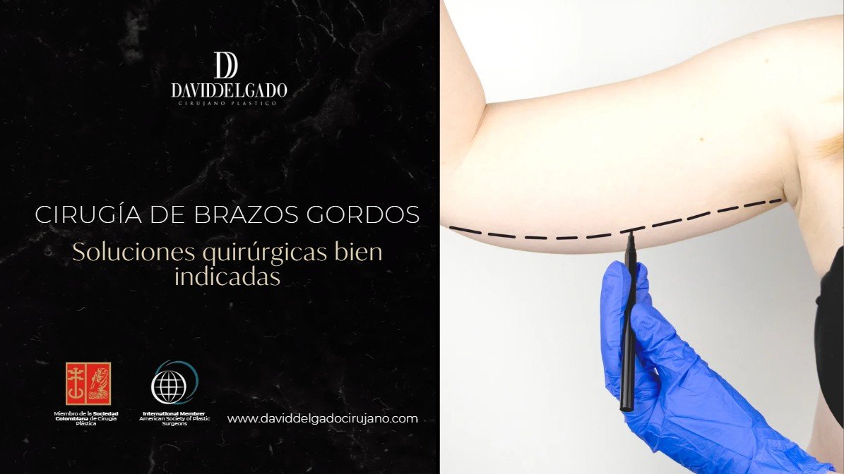 cirugía de brazos gordos-Dr. David Delgado