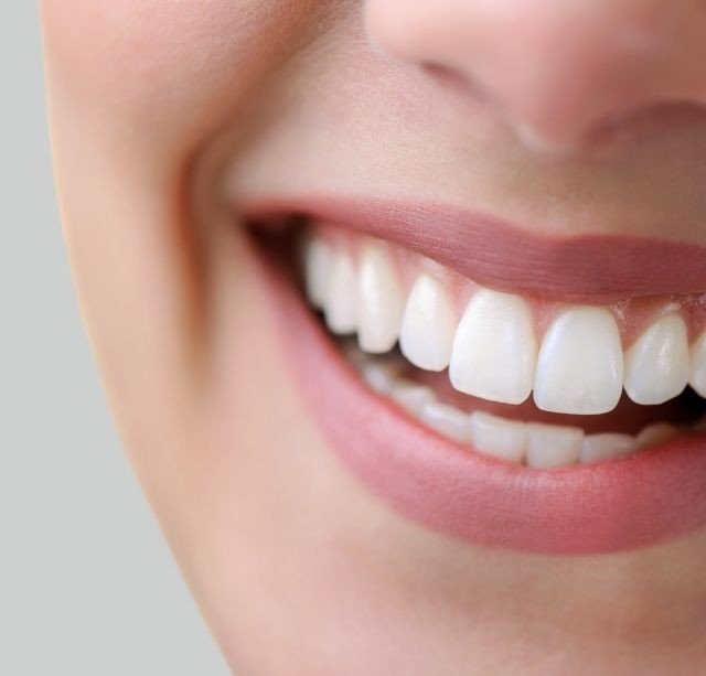 Diseño de Sonrisa Medellín - Torre Médica Oviedo -