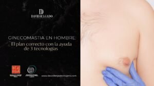 Ginecomastia en hombres- Dr. David Delgado