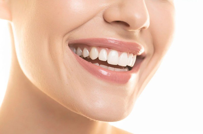 Limpieza dental en Colombia - Be Dharma Dental en Medellín