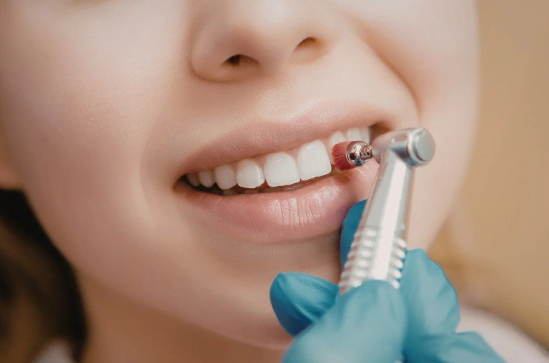 Profilaxis en Colombia - Be Dharma Dental en Medellín