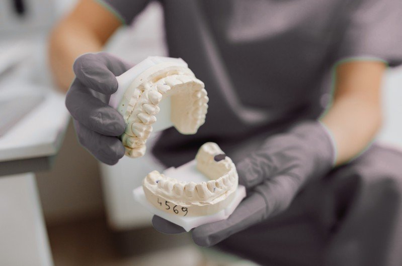 Prótesis dentales en Colombia - Be Dharma Dental en Medellín