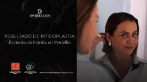 Testimonio Ritidoplastia- Dr. David Delgado