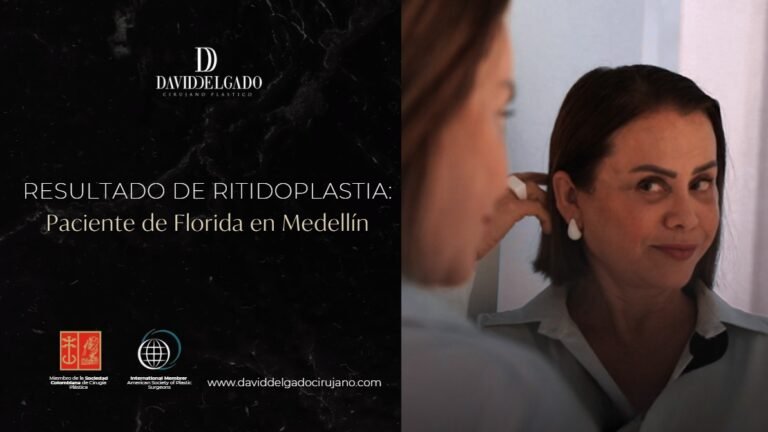 Testimonio Ritidoplastia- Dr. David Delgado