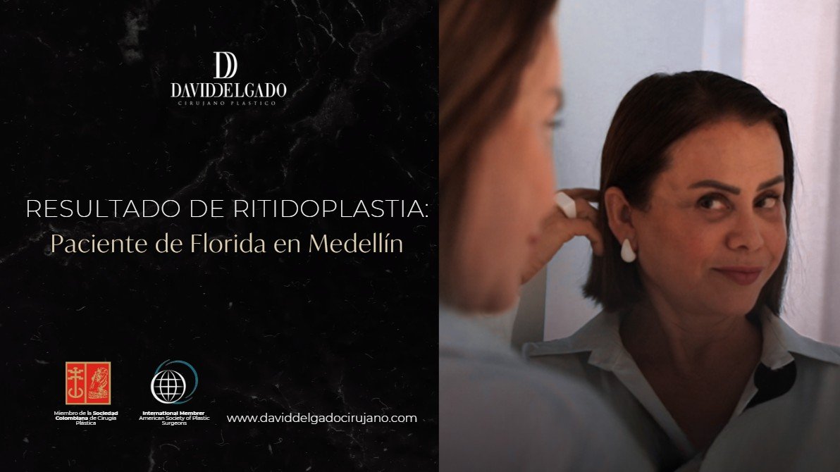 Testimonio Ritidoplastia- Dr. David Delgado