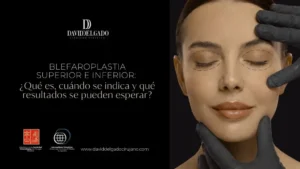 Blefaroplastia superior e inferior - Dr David Delgado Medellín