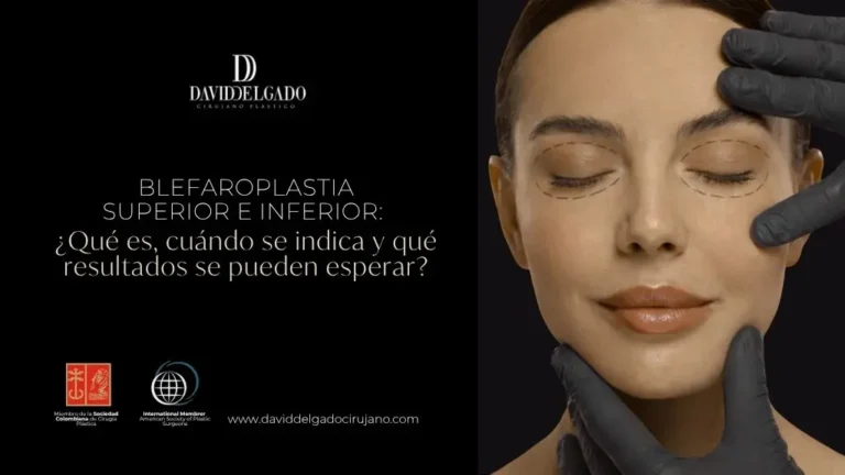 Blefaroplastia superior e inferior - Dr David Delgado Medellín