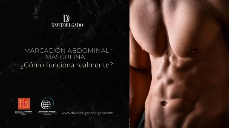 MARCACIÓN ABDOMINAL MASCULINA - DR. DAVID DELGADO (1)