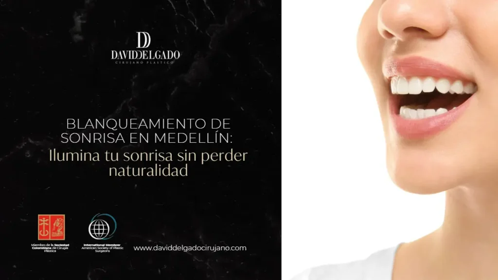 Blanqueamiento de sonrisa en Medellín- Be Dharma Dental