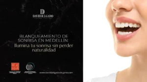 Blanqueamiento de sonrisa en Medellín- Be Dharma Dental