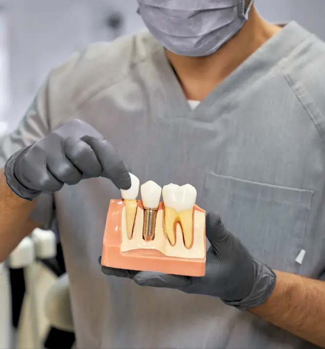 Implantes dentales en Medellín, Colombia - Clínica odontológica Be Dharma Dental - Cirujano plástico Medellín