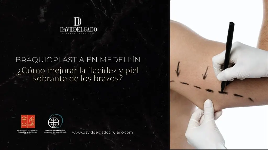 Braquioplastia en Medellín cómo mejorar la flacidez y piel sobrante de los brazos - cpm