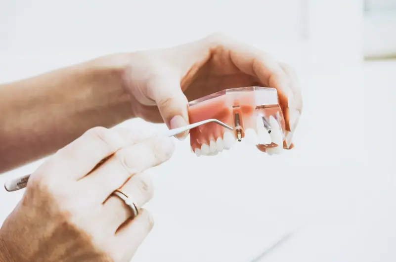 Los mejores implantes dentales de Medellín-Dharma Dental