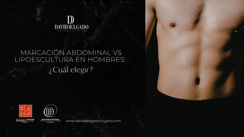 Marcación abdominal vs lipoescultura en hombres - Dr. David Delgado - Medellín, Colombia