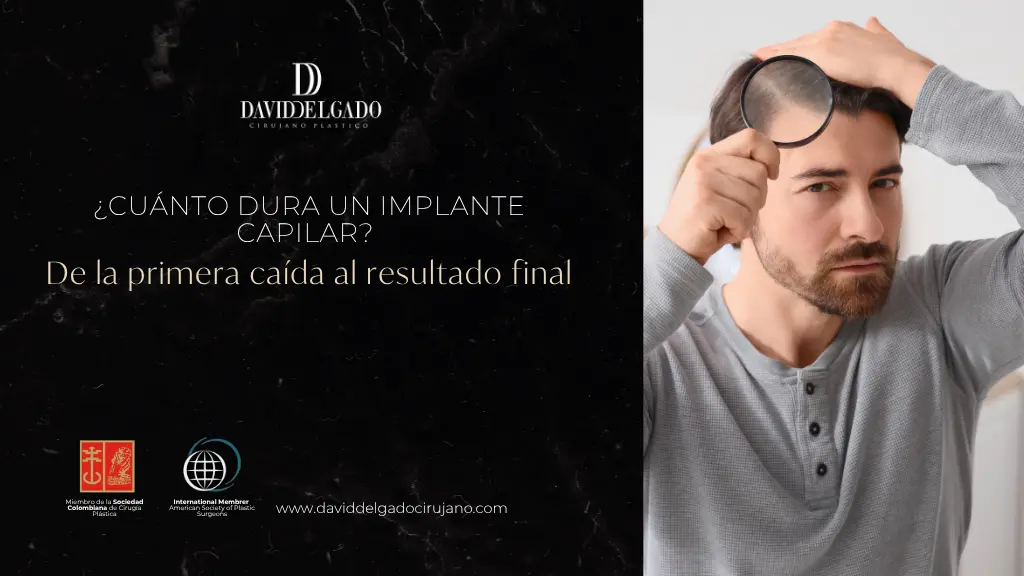 Cuánto dura un implante capilar - Dr. David Delgado - Medellín, Colombia